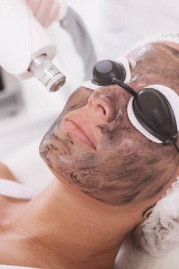 Close up of a mature woman wearing protective eyeglasses, getting carbon laser peel treatment by cosmetologist